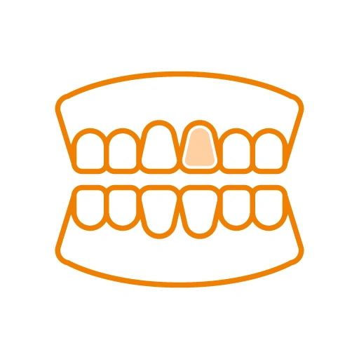 Discoloured or developmental defect tooth icon