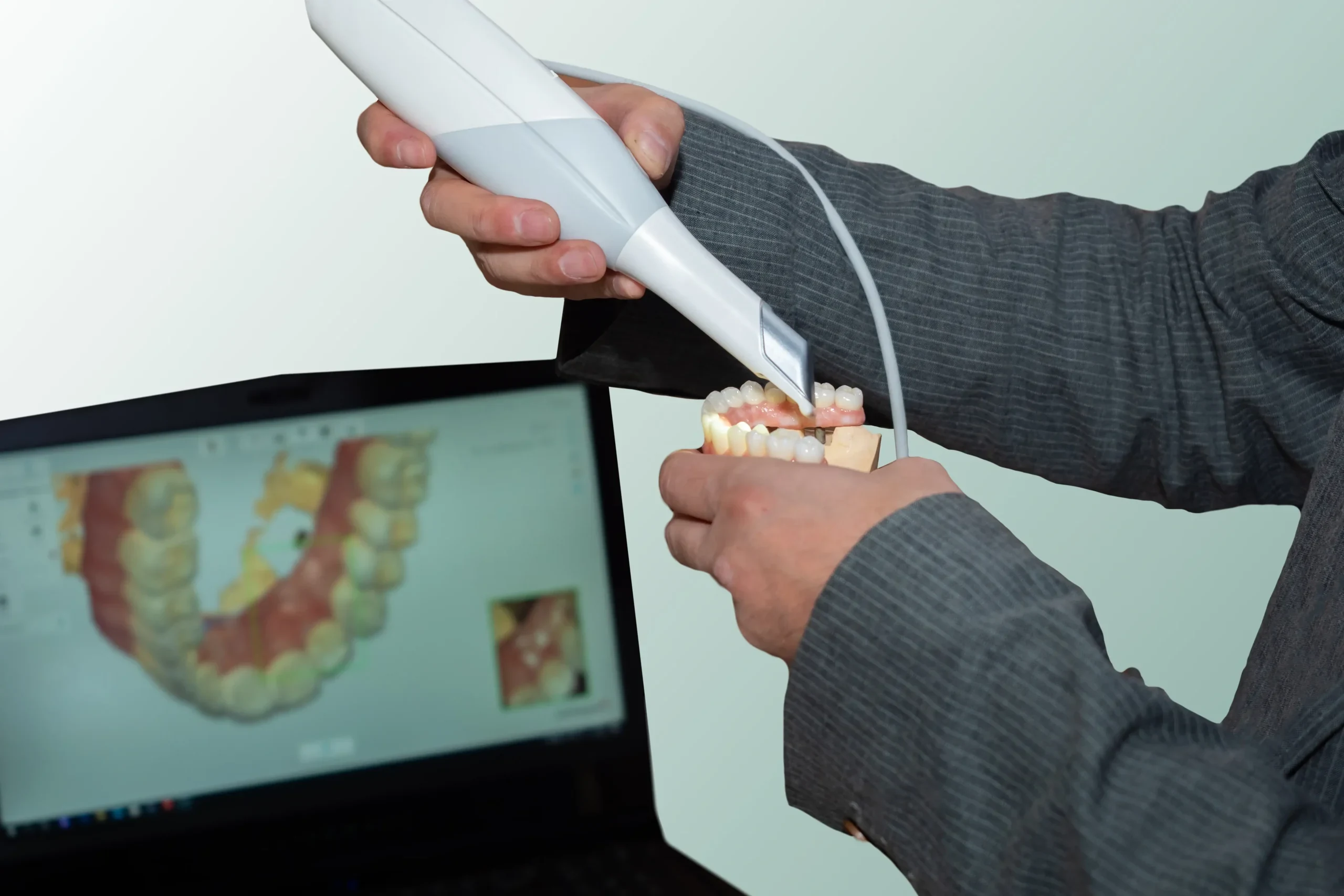 Intraoral digital scanner capturing 3D dental impression with live scan visible on monitor