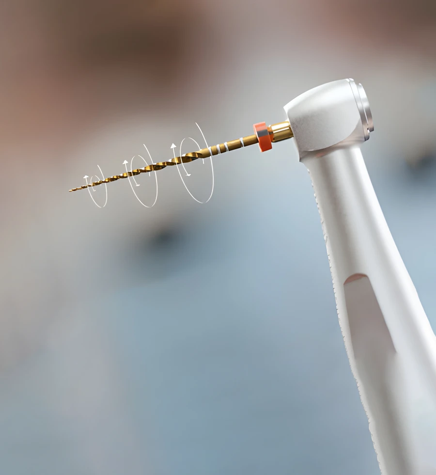 Close-up of a rotary endodontic nickel-titanium file mounted in a dental handpiece, with motion lines showing its rotating action